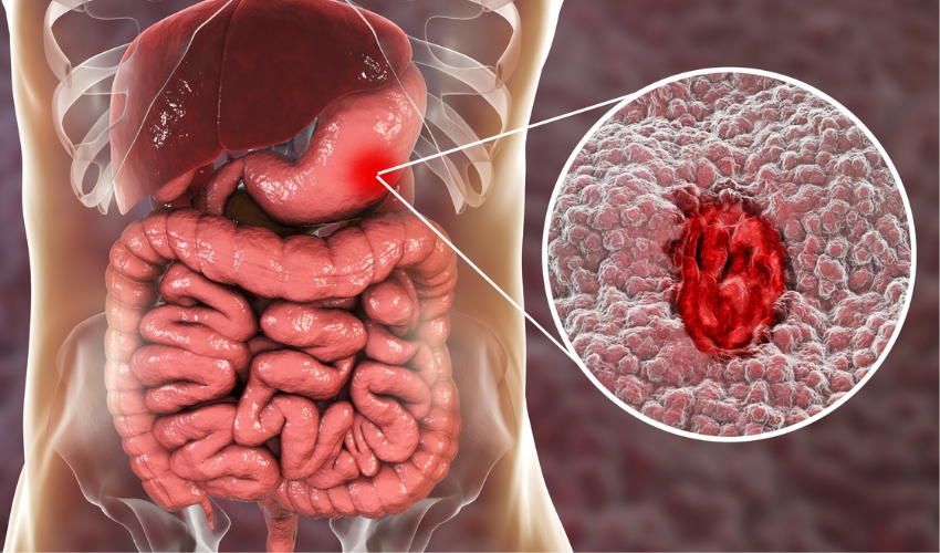 Gastro hospital in mancherial