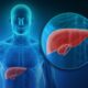 Everything You Need to Know About Liver Cirrhosis