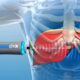 Liver FibroScan Test: What It Is, How It Works & Why It Matters