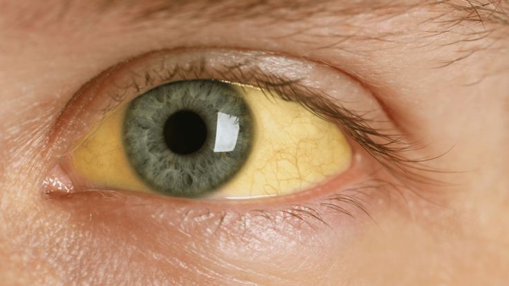 Yellow eyes