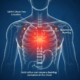 Frequent Throat Burning, Chest Discomfort & Stomach Burning